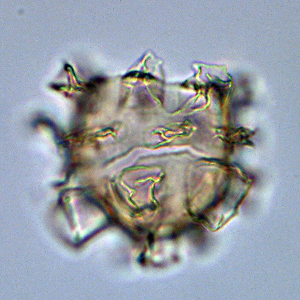 Hystrichokolpoma truncatum, U1581-20R-1W, 7-11, sl.1, E35-24, foto-b.jpg